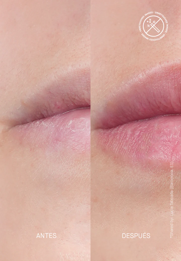 TRANSPARENT LAB Volume – Hydrating Lip-plumping Treatment - Image 4