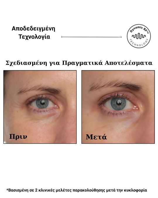 Sensilift™ – Συσκευή Ραδιοσυχνοτήτων (RF) για Ανόρθωση & Σύσφιξη Δέρματος - Image 6