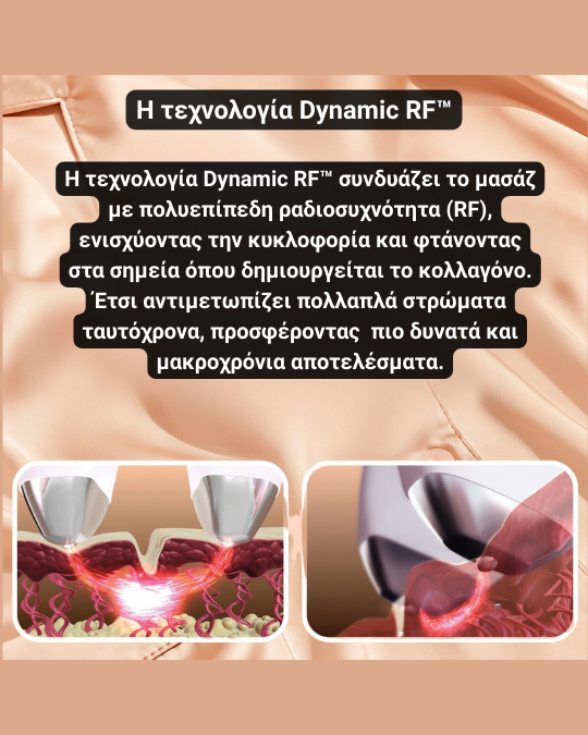 Sensilift™ – Συσκευή Ραδιοσυχνοτήτων (RF) για Ανόρθωση & Σύσφιξη Δέρματος - Image 7