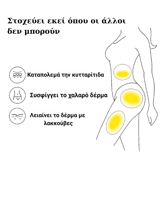 Sensifirm™ – Συσκευή Σύσφιξης & Αντιμετώπισης Κυτταρίτιδας με Ραδιοσυχνότητες (RF) - Image 10