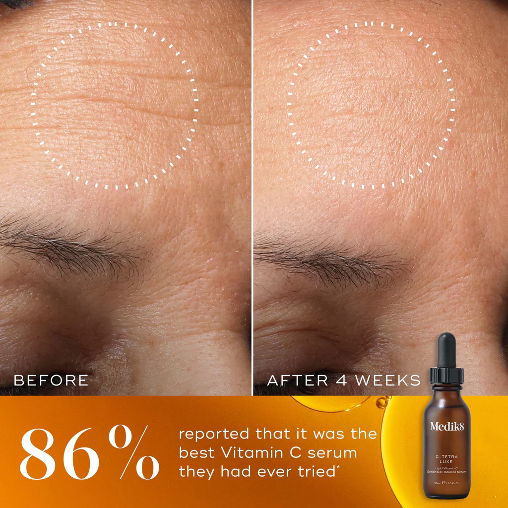 Medik8 C-Tetra Luxe – Lipid 14% Vitamin C Enhanced Radiance Serum (30ml) - Image 3